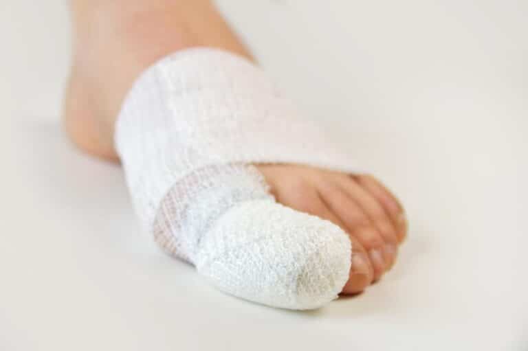 (Изображение повязки на сломанном пальце ноги. Изображение взято из Интернета)
