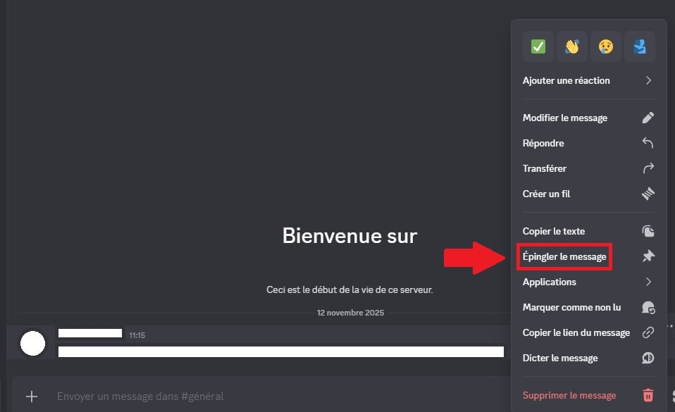 Bouton permettant d'Épingler un message sur Discord